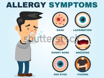 Allergiavizsgálat
